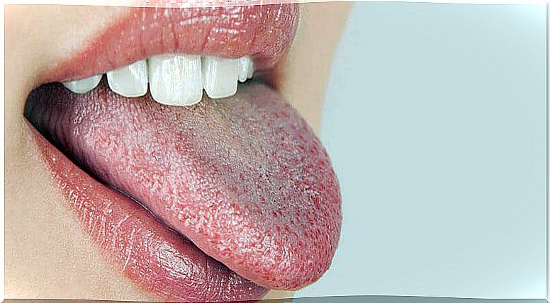 diabetes and dry mouth