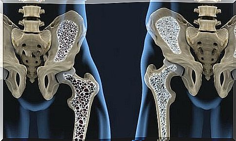 Preventing osteoporosis by using these products