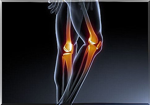 Leg bones - X-ray