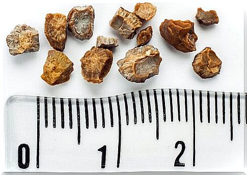 The size of the kidney stones