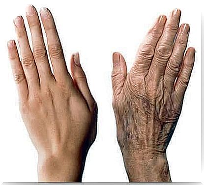 Hand skin - how to protect it against aging?