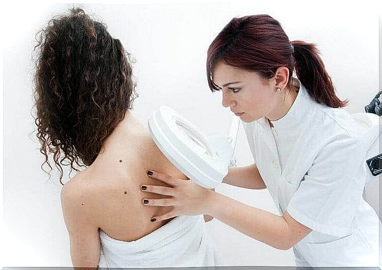 The dermatologist examines an unusual mole on the back