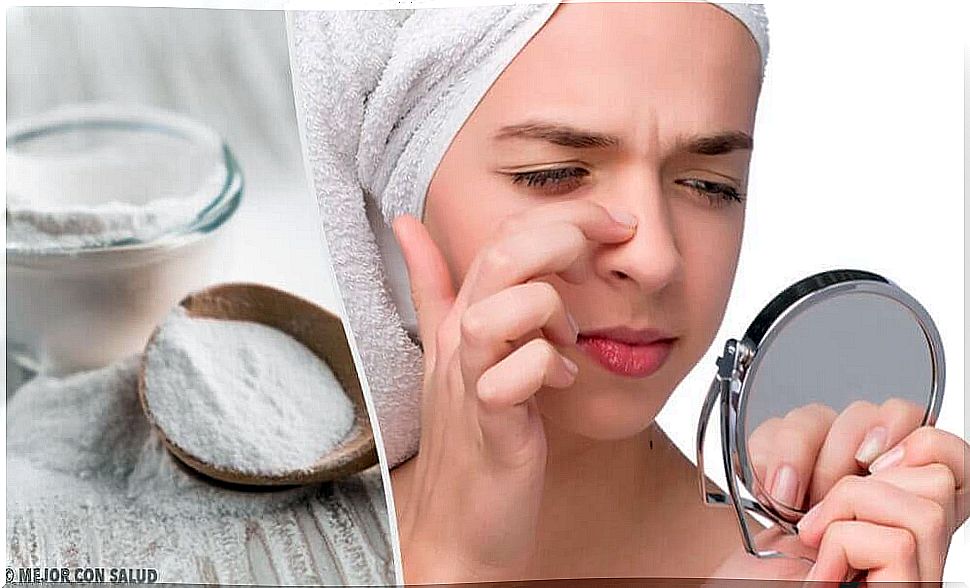 Blackheads - 4 effective baking soda masks