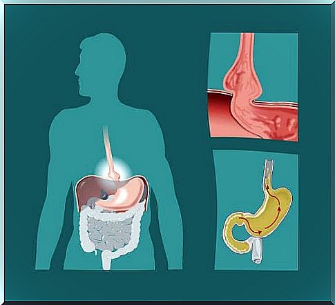 Digestive System Graphics