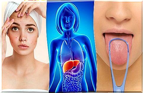 Liver loaded with toxins - 7 symptoms