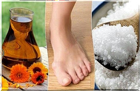 Natural remedies for bunions - 4 proven methods