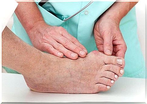 There are several possible causes of bunions.