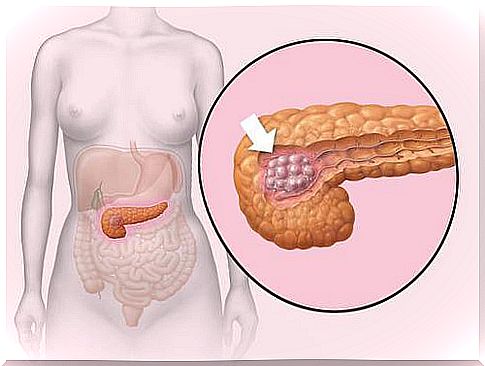 Pancreas - take care of it!