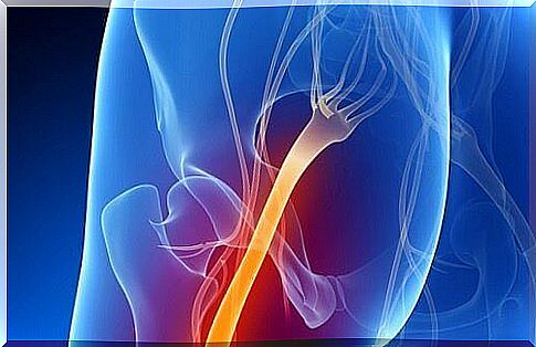 Sciatica - 5 warning signs