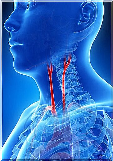 3 #: Carotid artery-hypertension.jpg