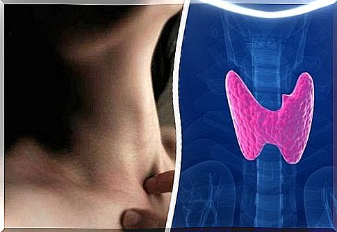 Thyroid problems - 10 symptoms