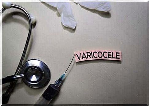 Varicocele: what should you know about them?